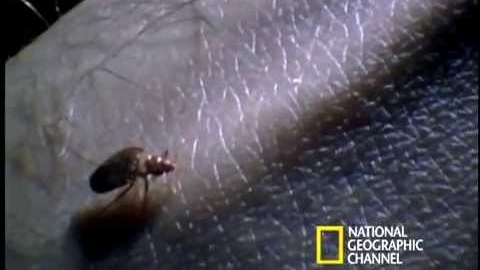 Watch Video : Bed Bugs Control Sydney